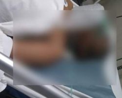 Tertimpa Ranting Pohon, Pemotor di Sidoarjo Pingsan dan Dilarikan ke Rumah Sakit