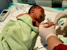 Bayi di Dharmahusada Indah Utara, Ditemukan di Atas Genteng Rumah Warga