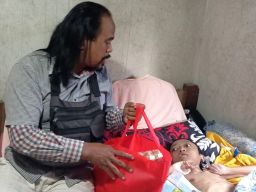 Kisah Ibu Sriyani, 16 Tahun Setia Merawat Kadek Budiana yang Lahir Prematur