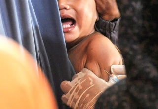 Menkes Tinjau Imunisasi Massal di Sumenep, 17 Anak Meninggal akibat Campak