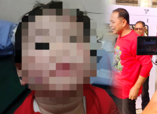 Kasus Balita Terluka, Pemkot Surabaya Tutup Mami Daycare Medokan Ayu