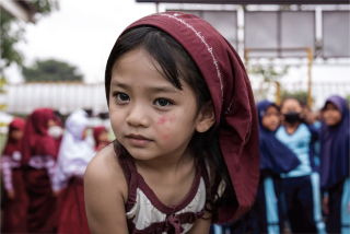 Korban Campak di Sumenep Bertambah 2 Orang, Vaksinasi Diperpanjang hingga 27 September