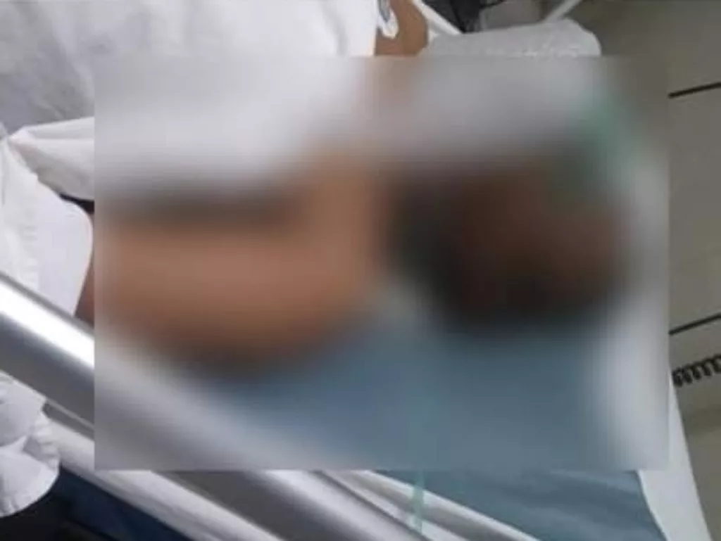 Tertimpa Ranting Pohon, Pemotor di Sidoarjo Pingsan dan Dilarikan ke Rumah Sakit