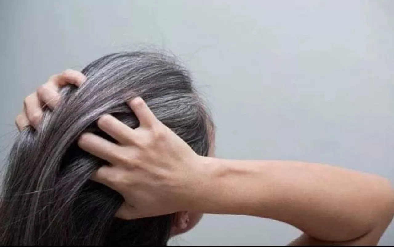 Ini 4 Penyebab Rambut Beruban di Usia Muda