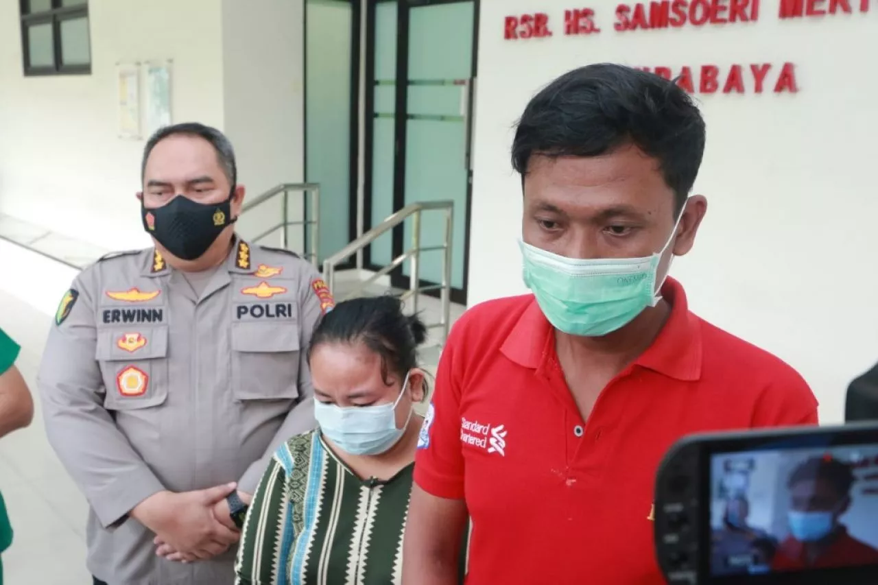 HUT Bhayangkara ke 76, Biddokkes Polda Jatim Gelar Operasi Hidrosefalus