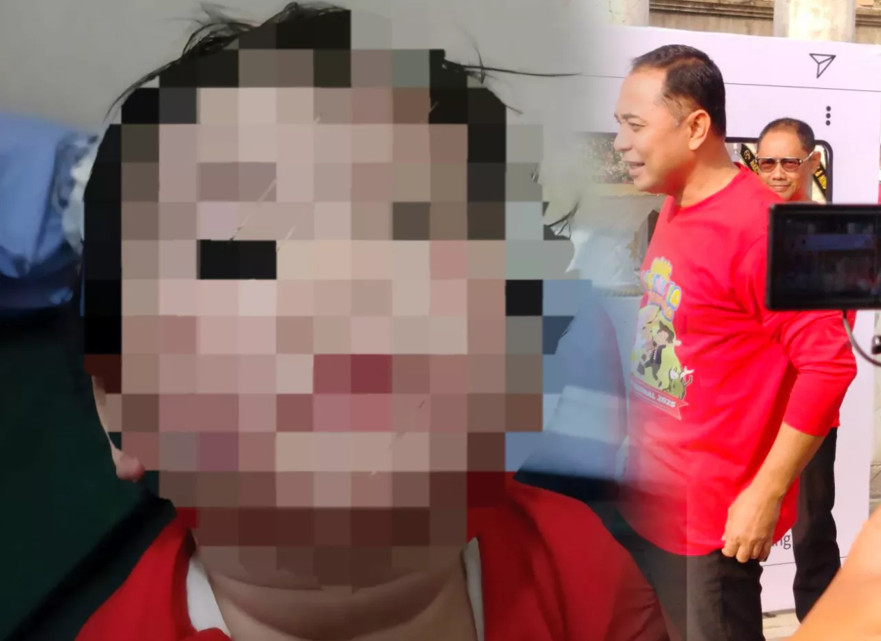 Kasus Balita Terluka, Pemkot Surabaya Tutup Mami Daycare Medokan Ayu