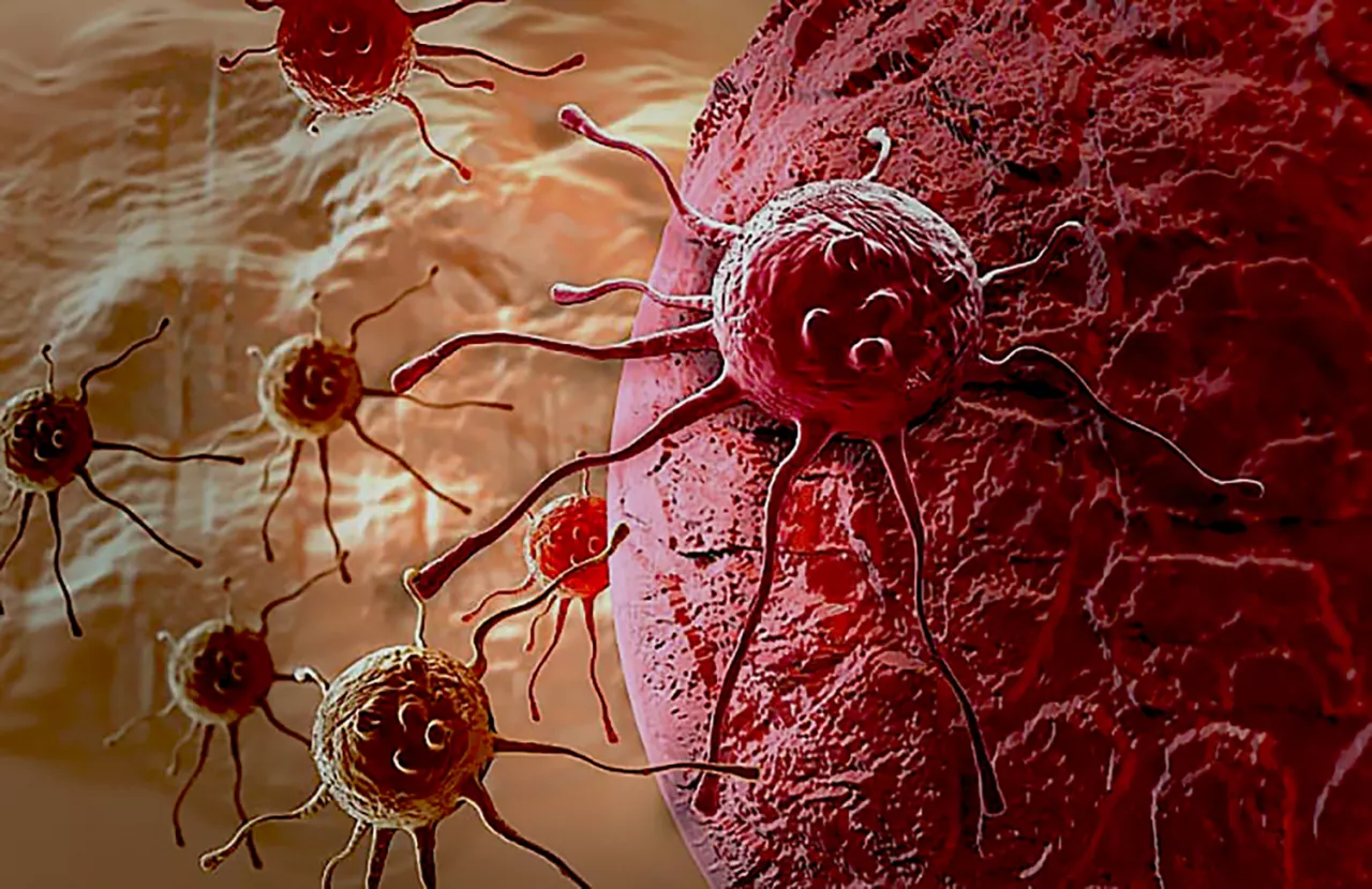 Ilmuwan Rusia Sukses Kembangkan Vaksin Kanker Berbasis mRNA, Efektif Hambat Pertumbuhan Tumor